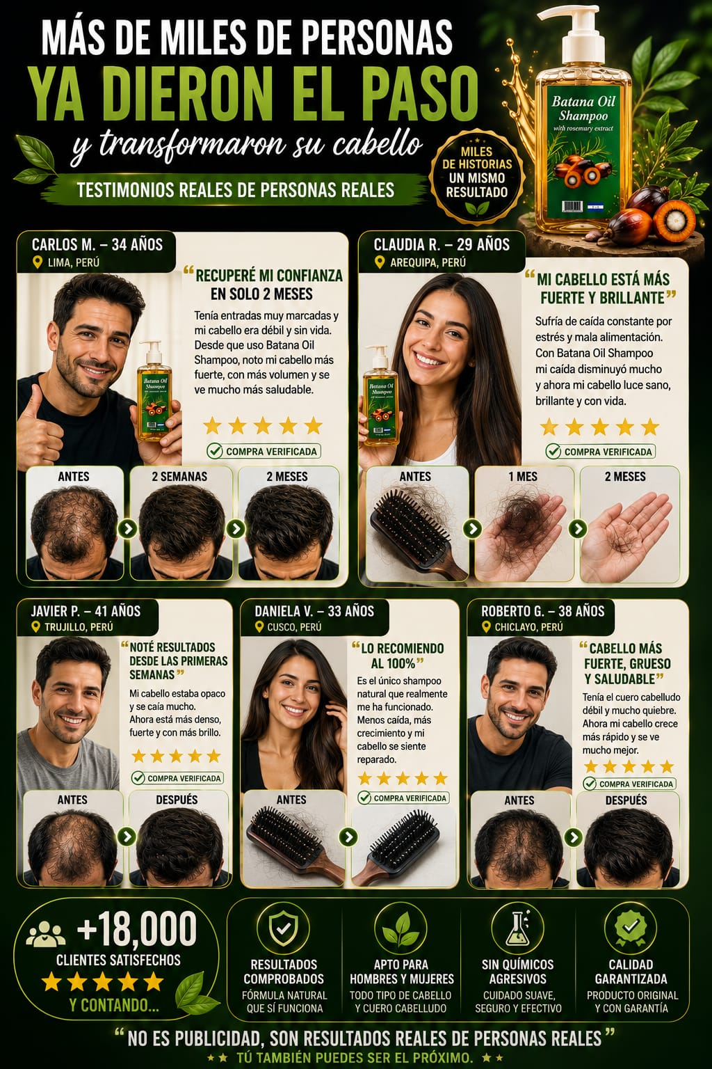 serum anti caida de cabello